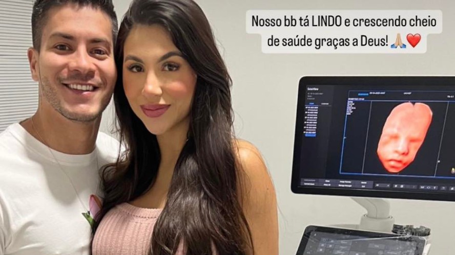 Arthur Aguiar e ex-namorada, Jheny Santucci, posam juntos e mostram ultrassom do bebê | GQ | GQ