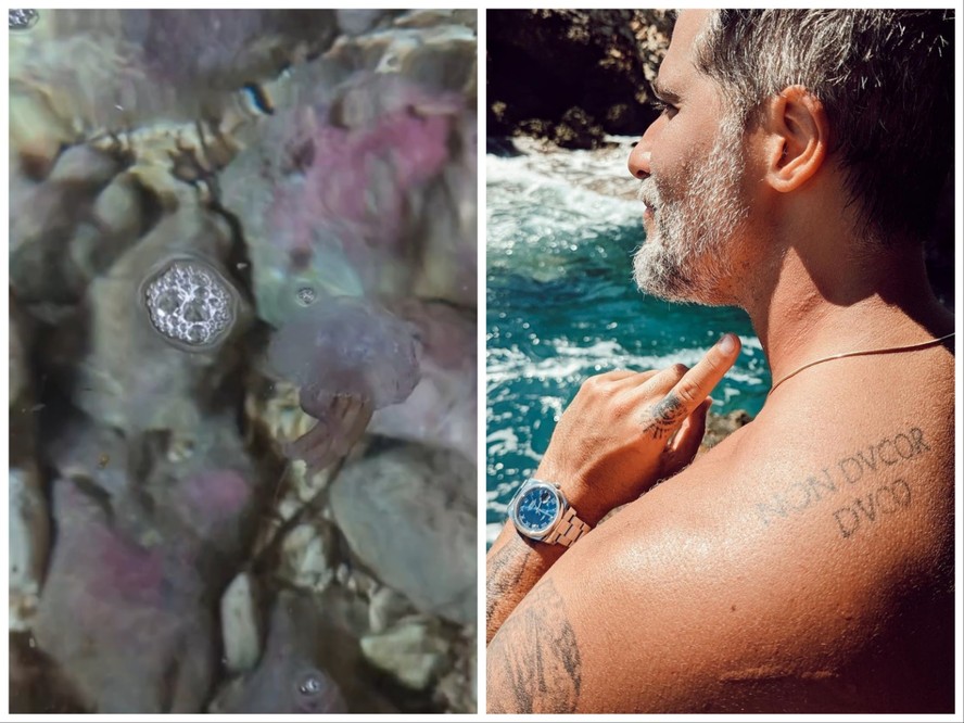 Bruno Gagliasso relata queimadura de água-viva em ilha na Espanha