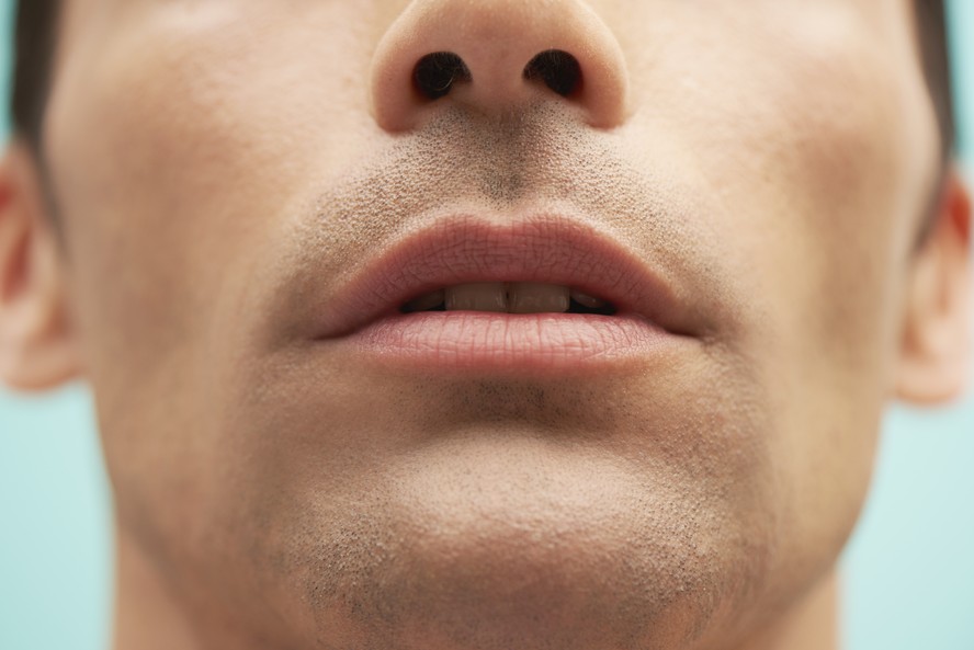 O preenchimento labial é um dos procedimentos estéticos que têm ganhado cada vez mais adeptos