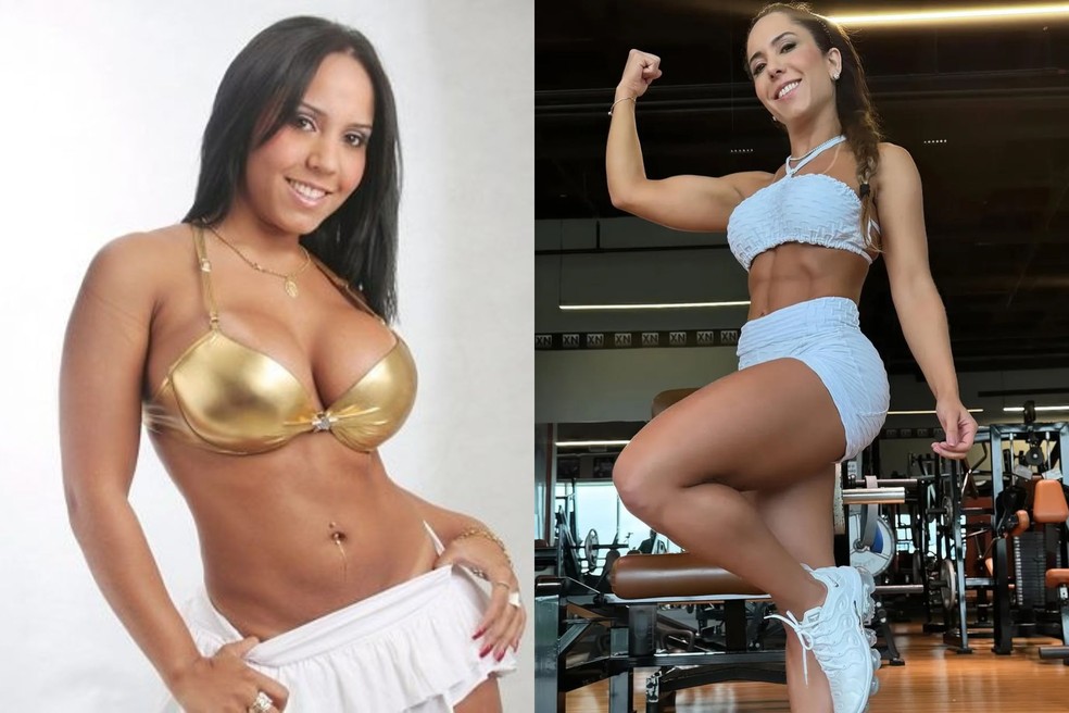 Antes e depois de Renata Frisson, a Mulher Melão — Foto: Reprodução; Reprodução/Instagram