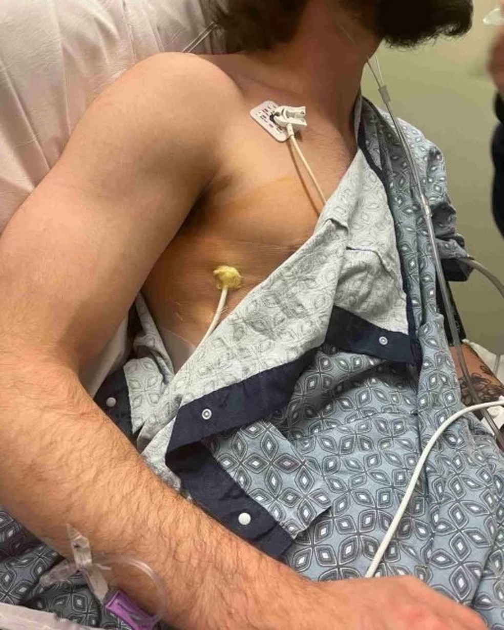 Jovem de 20 anos ainda se recupera de cirurgia de retirada de parte do pulmão — Foto: Reprodução/Facebook