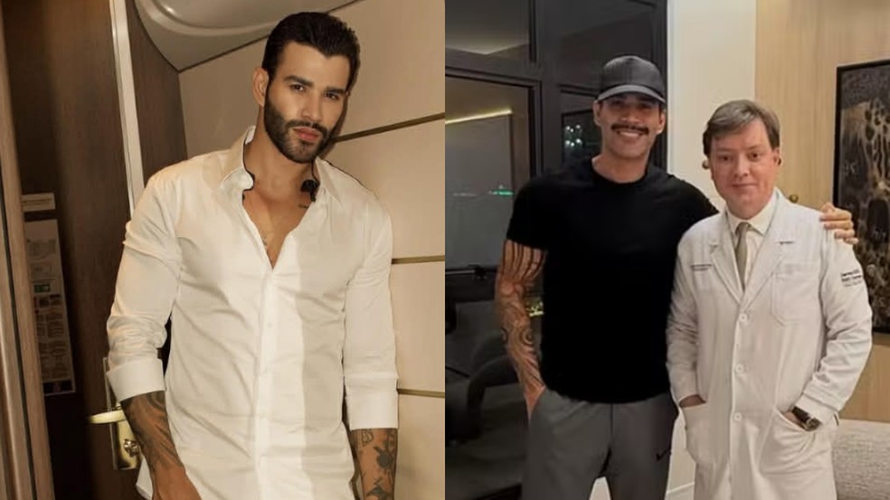 Gusttavo Lima: antes e depois — Foto: Instagram