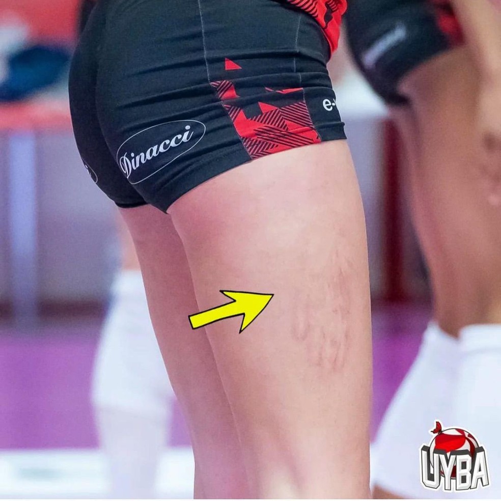 Marca na perna foi resultado de tapa de Lloyd — Foto: Reprodução / Instagram