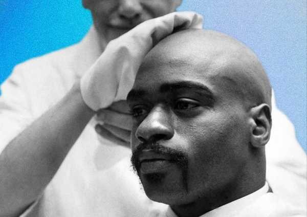 Você sabe cuidar da sua careca? Veja dicas e produtos para usar na região