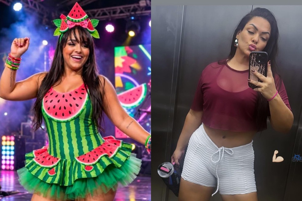 Antes e depois de Andressa Soares, a Mulher Melancia — Foto: Reprodução/Instagram